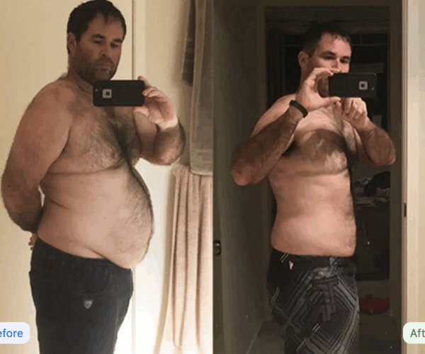 Thinnex-before-and-after-guy-in-black-pants